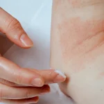 Mitos atau Fakta, Vasektomi Bisa Menurunkan Kepuasan Seksual?